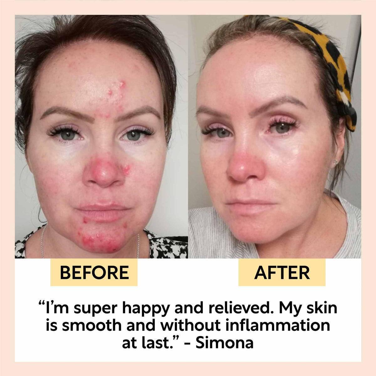 Night Cream with Hyaluronic Acid Niacinamide Hydrating Facial Moisturizer